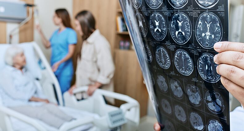 Long Beach Delayed Treatment of Strokes Long Beach Delayed Treatment of Strokes